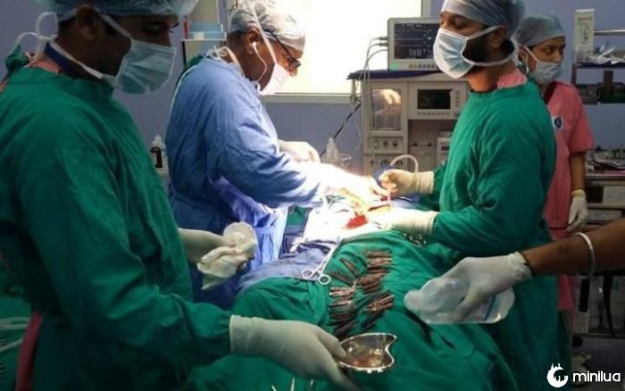 Stomach knives india surgery swallow